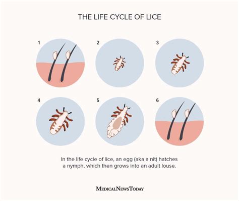 Life Cycle Of Lice Stages How They Spread And More Lice Life Cycle Life Cycles Louse