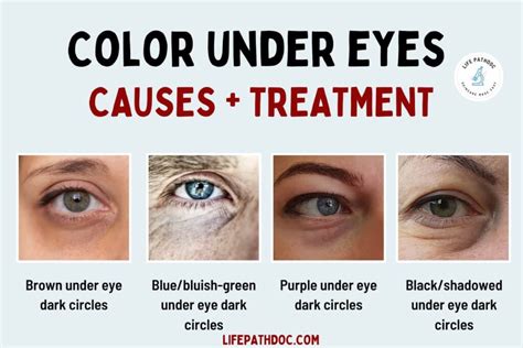 What Do Under Eye Colors Mean Purple Blue Brown Black