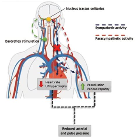 Baroreflex Activation Therapy By The Rheos System™ And The Barostim