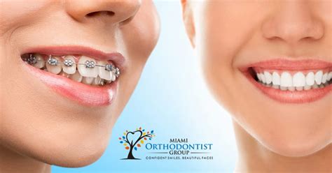 Dentofacial Orthopaedics V S Orthodontics Which Is Best Miami