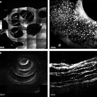 Expected imaging results after tissue clearing of spiral ganglion ...