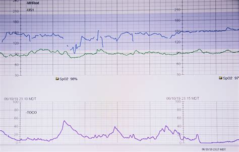 Cardiac Sonography Programs in Chicago | Ultrasound Tech Schools in Chicago