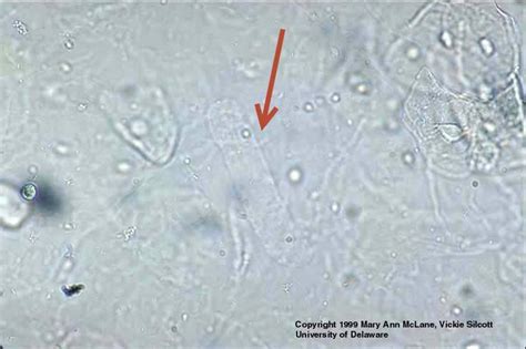 Hyaline Cast Medical Laboratories