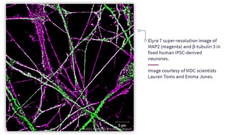 Advanced Microscopy At Medicines Discovery Catapult