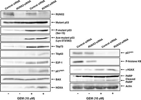 Depletion Of Pro Oncogenic Runx2 Enhances Gemcitabine Gem Sensitivity