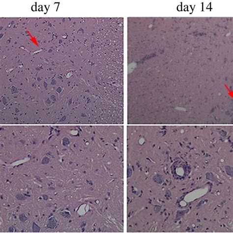 Histological Characterization Of The Spinal Cord In Rats With Eae The