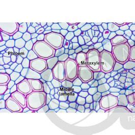 Lycopodium Sp Ground Pine Stem Protostele Transverse Section X