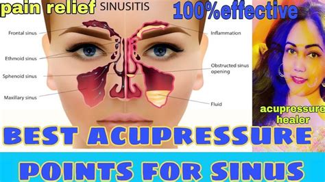 SINUS ACUPRESSURE POINTS IN HINDI / SINUS ACUPRESSURE POINTS BY ...