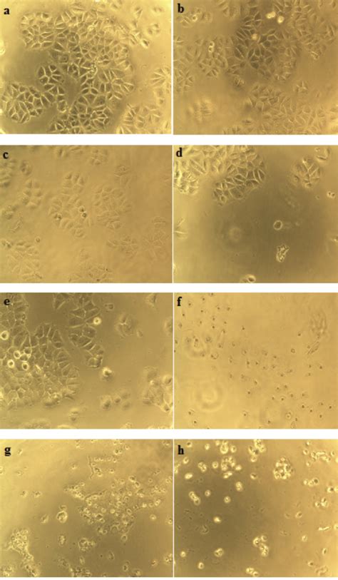 Morphological Alterations Of Mcf 7 Cells After 24 H Of Treatment Of The Download Scientific