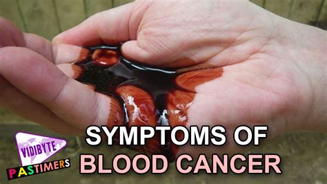 Blood Cancer Types And Symptoms