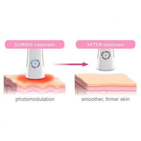Аппарат для омоложения и подтяжки кожи с функцией светотерапии Skin ...