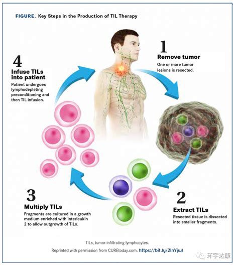 癌症肿瘤治疗新方法 肿瘤新疗法 肿瘤新技术 肿瘤浸润淋巴细胞TILs个性化免疫治疗有望在2022年上市 全球肿瘤医生网
