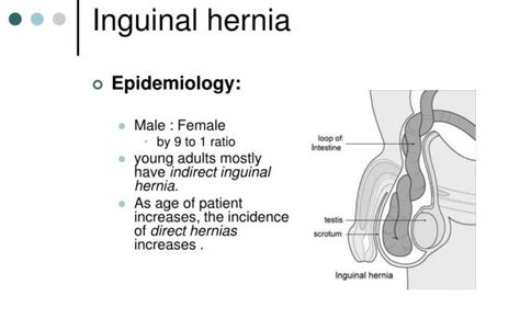 Inguinal Hernia Symptoms Male Mricases Right Inguinal Hernia – Otosection