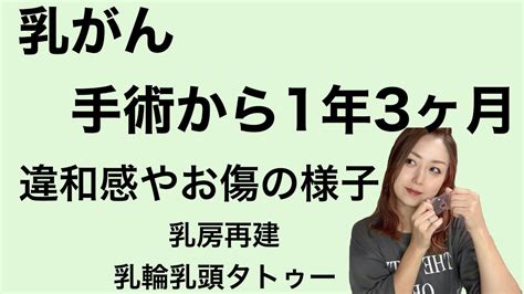 お傷の写真あり乳がんまだまだ痛々しいので苦手な方はみないでくださいね術後1年3ヶ月お傷の様子全ての再建が終了乳輪乳頭タトゥーの