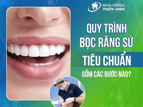 Hiểu rõ quy trình bọc răng sứ để có lựa chọn đúng Beauty Place Blog