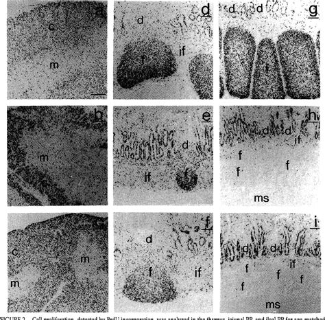 Figure From Two Distinct Pathways Of B Cell Development In Peyer S