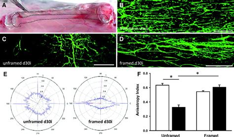 Determinants Of Microvascular Network Topologies In Implanted