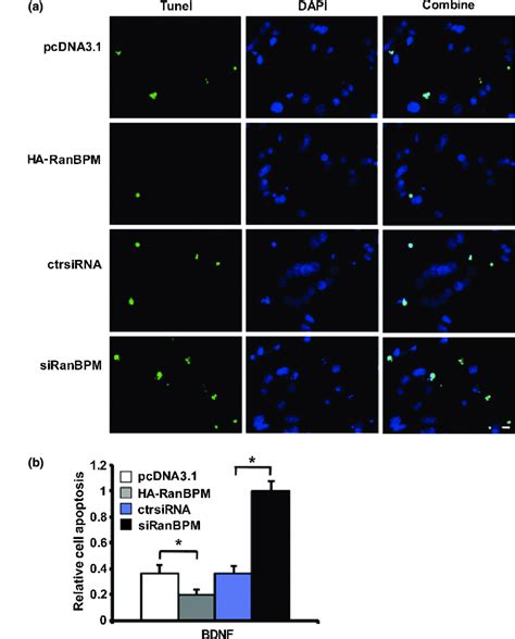 Ranbpm Enhances Protective Effect Of Bdnf On Serum Deprivation Induced