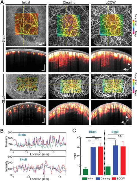 A LongTerm Clearing Cranial Window For Longitudinal Imaging Of