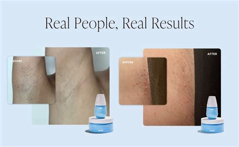 Amazon Bushbalm Ingrown Hair And Razor Bumps 2 Step Routine Moisturize And Soothe Nude