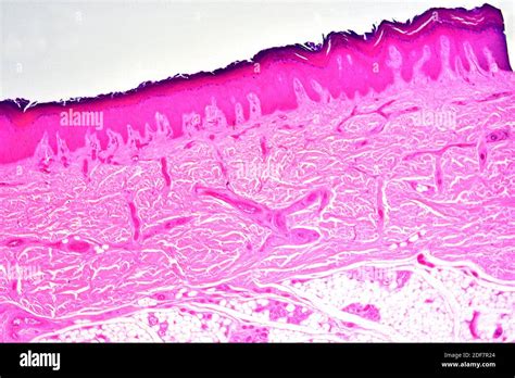 Stratified Squamous Epithelium High Resolution Stock Photography And