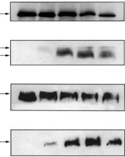 Western Blot Analysis Of Procaspase 3 A Cleaved Caspase 3 B Poly