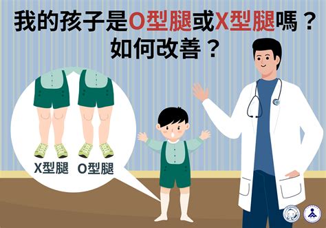 我的孩子是o型腿或x型腿嗎？如何改善？ 台灣復健醫學會