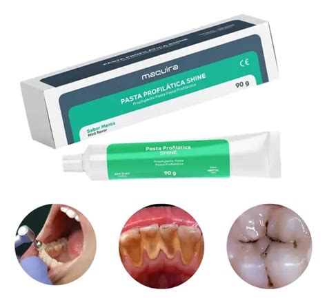 Melhor Creme Dental Para Tartaro - Creme Dental Para Tártaro - Profilaxia Profissional - Shine | MercadoLivre