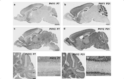 Expression Of Phy And Phy Mrna In Mouse Brains A B In Situ