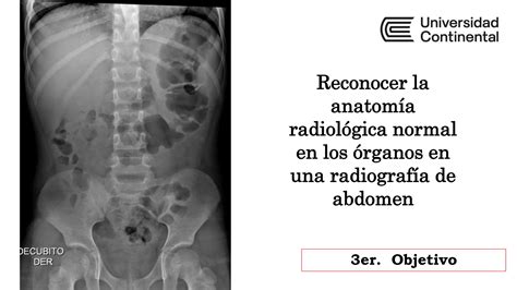 Taller De Habilidades Lectura Sistematica De Una Radiografia De Abdomen