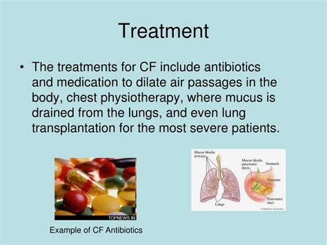 Ppt Cystic Fibrosis Powerpoint Presentation Free Download Id3980695