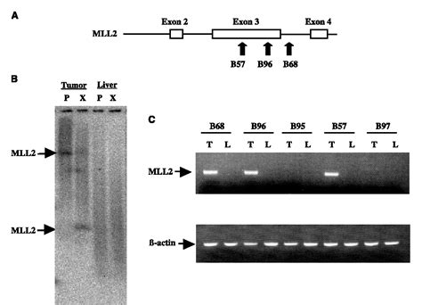 Figure 2 From Alteration Of Gene Expression In Human Hepatocellular