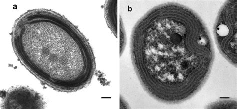 1 Transmission Electron Micrographs Of Negatively Stained Thin