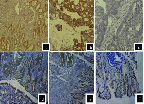 Photomicrographs Of COX 2 Immunohistochemistry A COX 2 Positive Normal