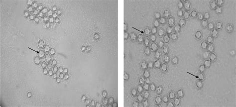 Photomicrograph Of Pathogenic Acanthamoeba Genotype Cysts Isolated From Download Scientific