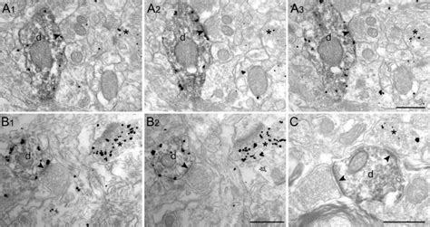 Lack Of Detectable Innervation By Vglut2 Containing Axon Terminals Of