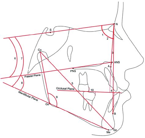 Cephalometric Landmarks And Measurements Cephalometric Landmarks S Download Scientific