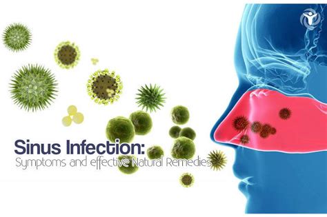 Sinus Infection: Symptoms and Effective Natural Remedies