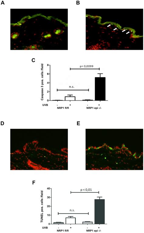 To Investigate Uvb Induced Apoptosis In Vivo Epidermis Specific Nrp