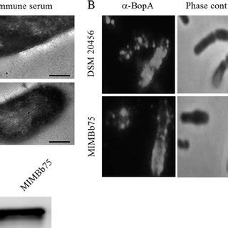 Subcellular Localization Of Bopa In B Bifidum Dsm And Mimbb