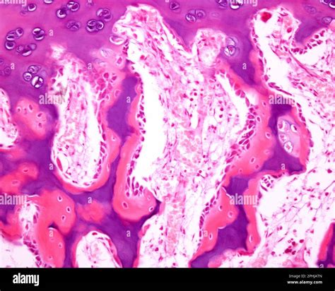 Endochondral Ossification Histology