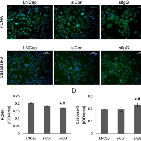 IGHG1 Silencing Attenuates The Cell Cycle Progression Of LNCaP Cells