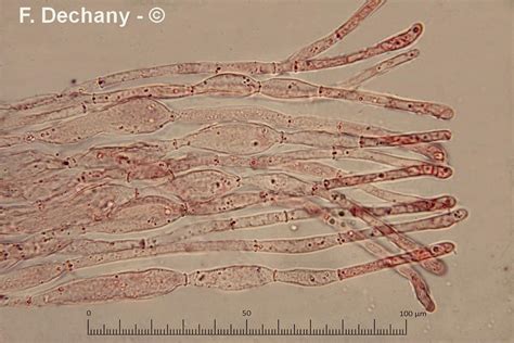 Microscopie Paraphyses De Peziza Varia J Pellicani F Corhay B