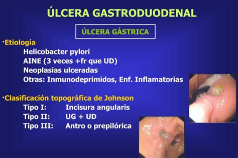 Ppt Aplicaciones De La Endoscopia En El DiagnÓstico De Las