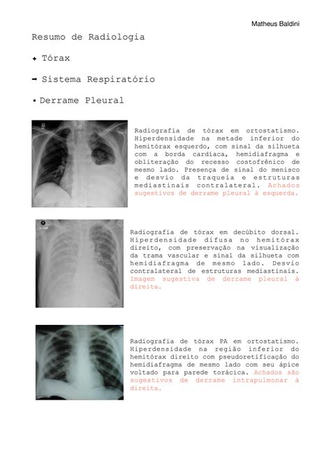 Solution Tabela De Todas As Descri Es De Radiologia Torax Abdome