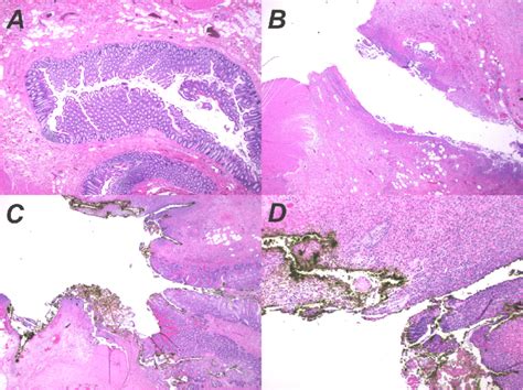 Histological Preparation Of Surgical Specimen Hematoxylin And Eosin