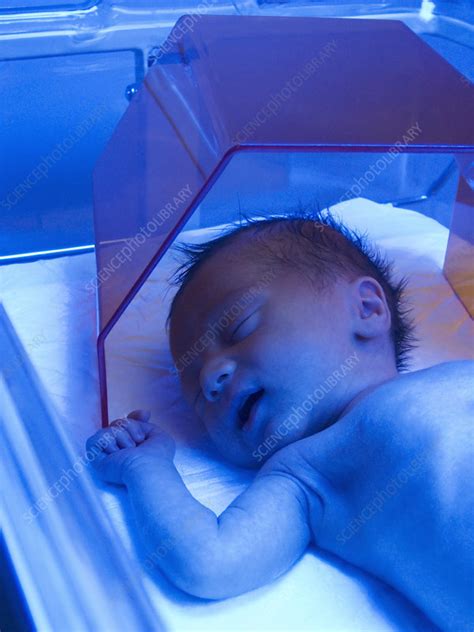 Phototherapy Lights For Jaundice Shelly Lighting