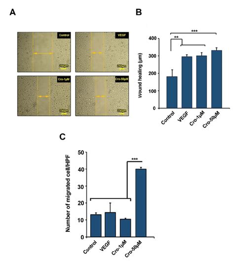 Scratch Assay Was Performed To Measure Cell Migration 72 H After Being Download Scientific