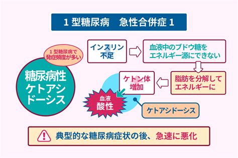 1型糖尿病の基本情報と治療法！急性合併症についても解説