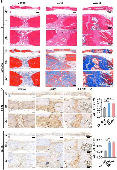 In Vivo Bone Regeneration After Weeks Of Implantation Of The Bone